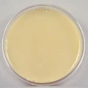 8.3: Protein Hydrolysis w. Procedures and Results.